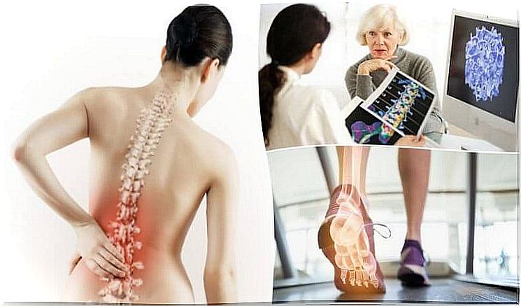 Osteoporosis can cause back pain