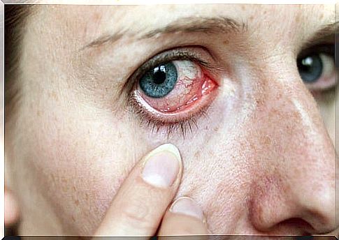 Recognize signs of illness in the eyes