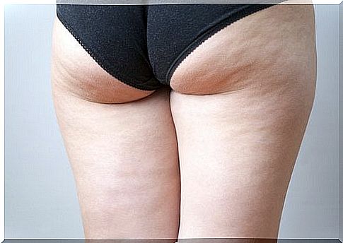 Improve cellulite by brushing the skin