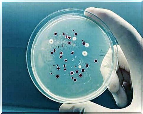 Fungal culture in the laboratory - Pityriasis versicolor