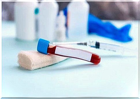 Erythrocyte Sedimentation Rate - What is it?