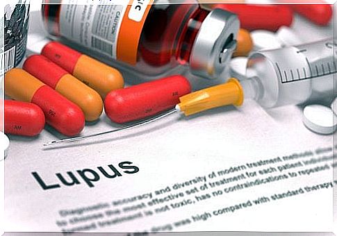 Lupus 