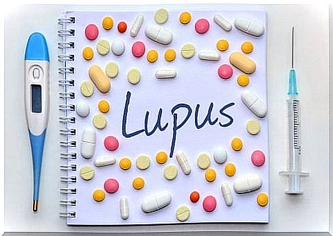 Lupus