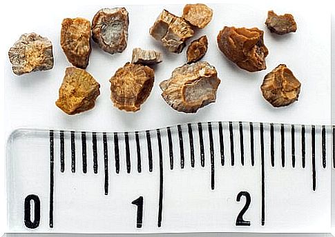 Get rid of kidney stones