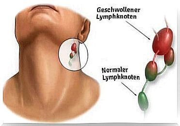 Lump on the neck