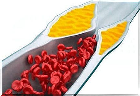 Cholesterol and diet