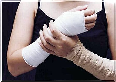 Plaster of paris and splint: woman with two arms joined together