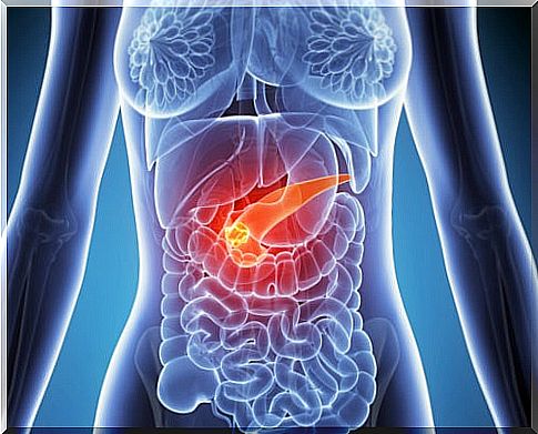 Pancreas as a trigger for right-sided abdominal pain