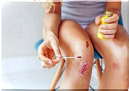 A person cleaning a cut on the knee to treat an infected wound.