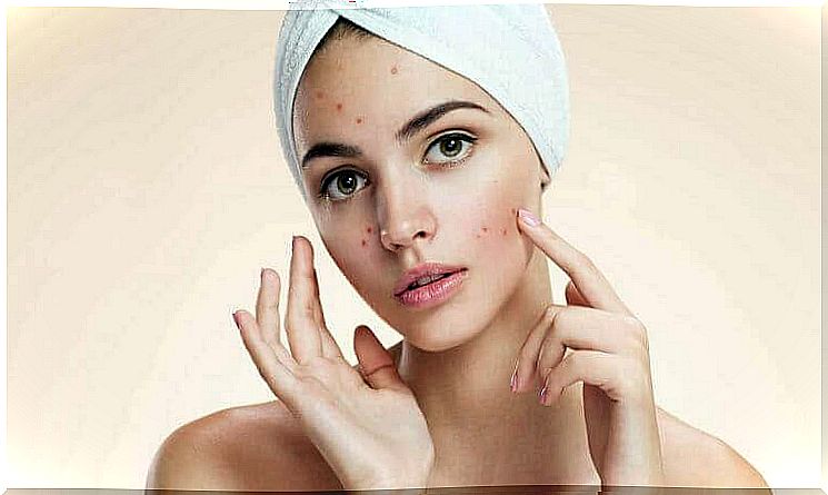 The most common skin problems: acne