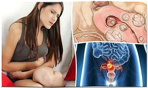 Uterine fibroids: 5 facts every woman should know