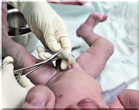 Cutting the umbilical cord